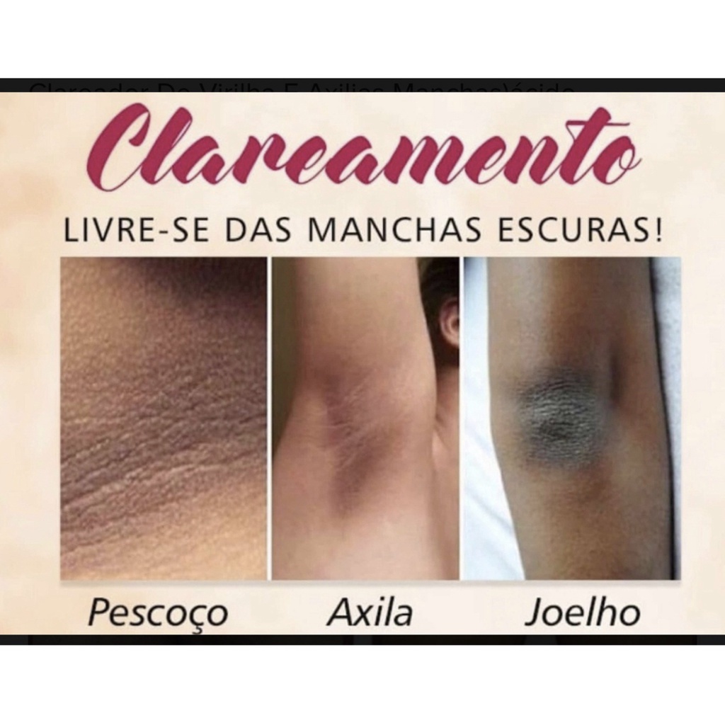 Clareador De Manchas Facial E Corporal Shopee Brasil