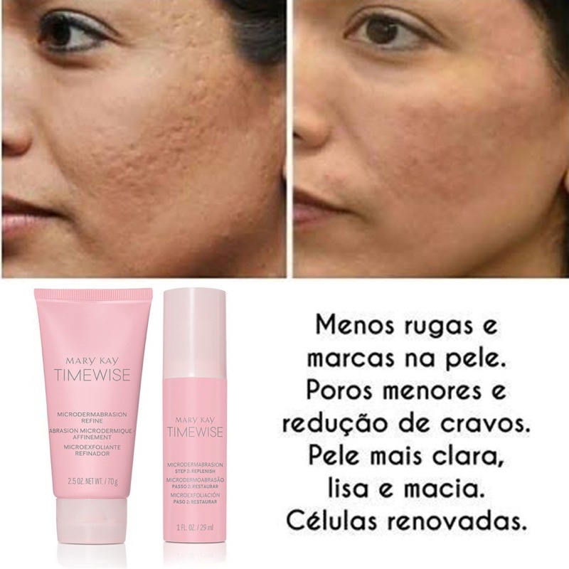 Kit Microdermoabrasão Mary Kay Peeling Passo 1 Refina e Passo 2