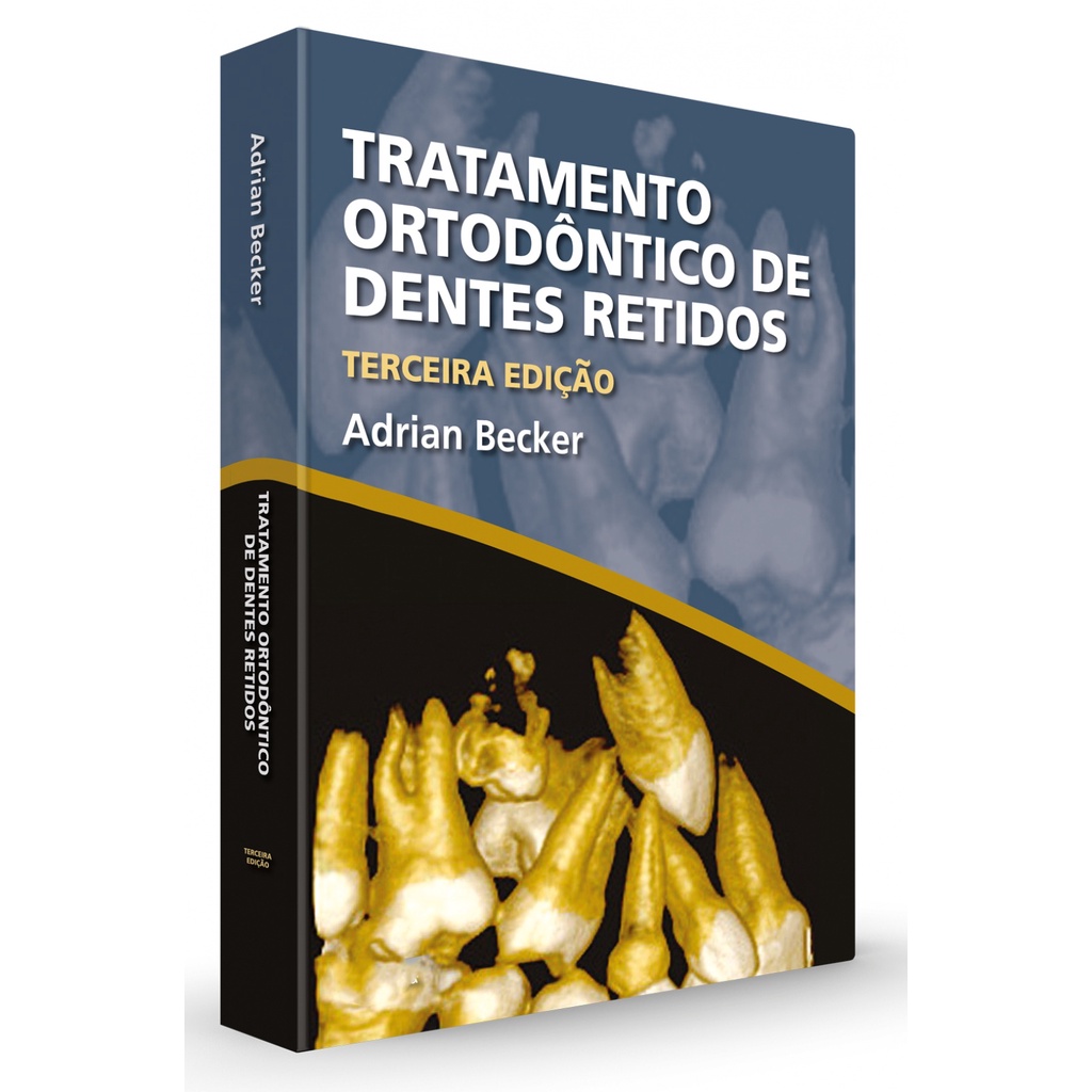 Livro Tratamento Ortodôntico De Dentes Retidos 3ª edição Adrian Becker