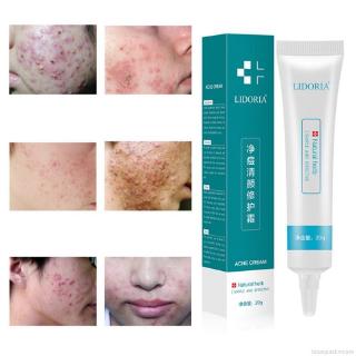 Lidoriaria Soro Facial Remover Acne Encolher Poros Pele Firmeza