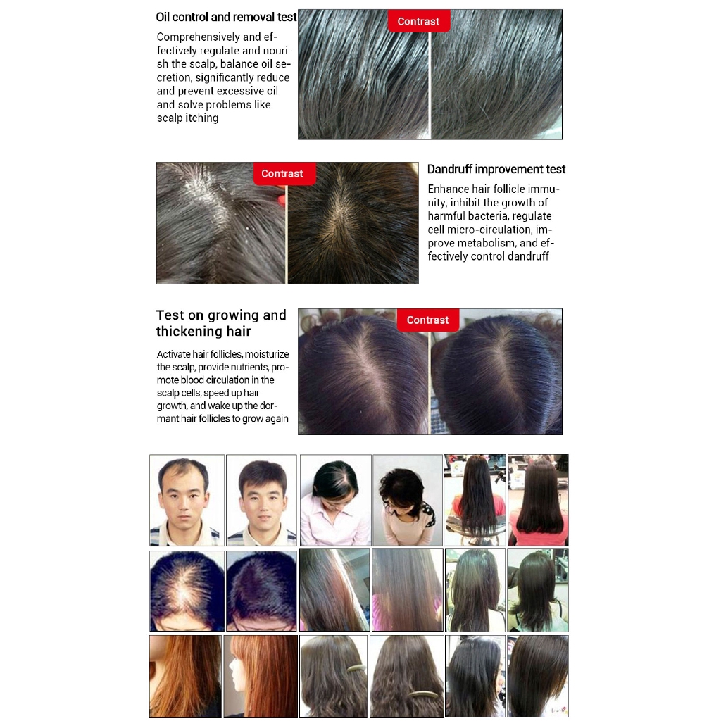 Original Andrea Hair Growth Essence Dense Anti Hair Loss Liquid Essence Oil  20ml | Shopee Brasil