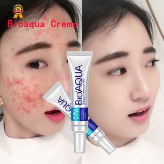 Creme Bioaqua Clareador Para Tratamento Da Pele Acne De Controle De Oleosidade Cicatrizes Facial Poros