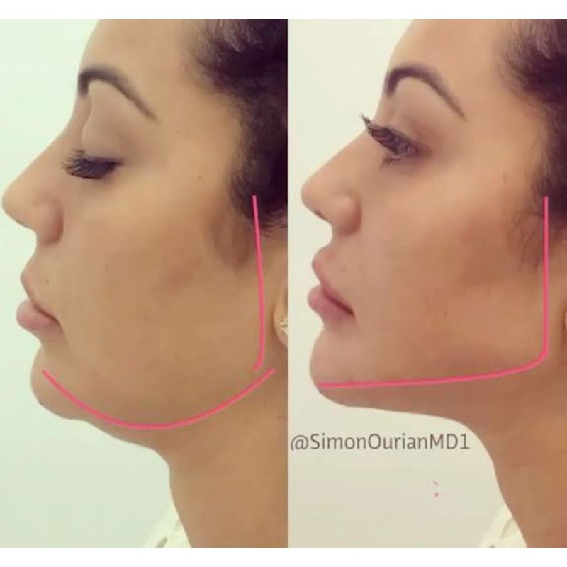 Jawline exercício de mandíbula definir mandíbula Jawliner harmonização  facial Jawzrsize mastigar bola