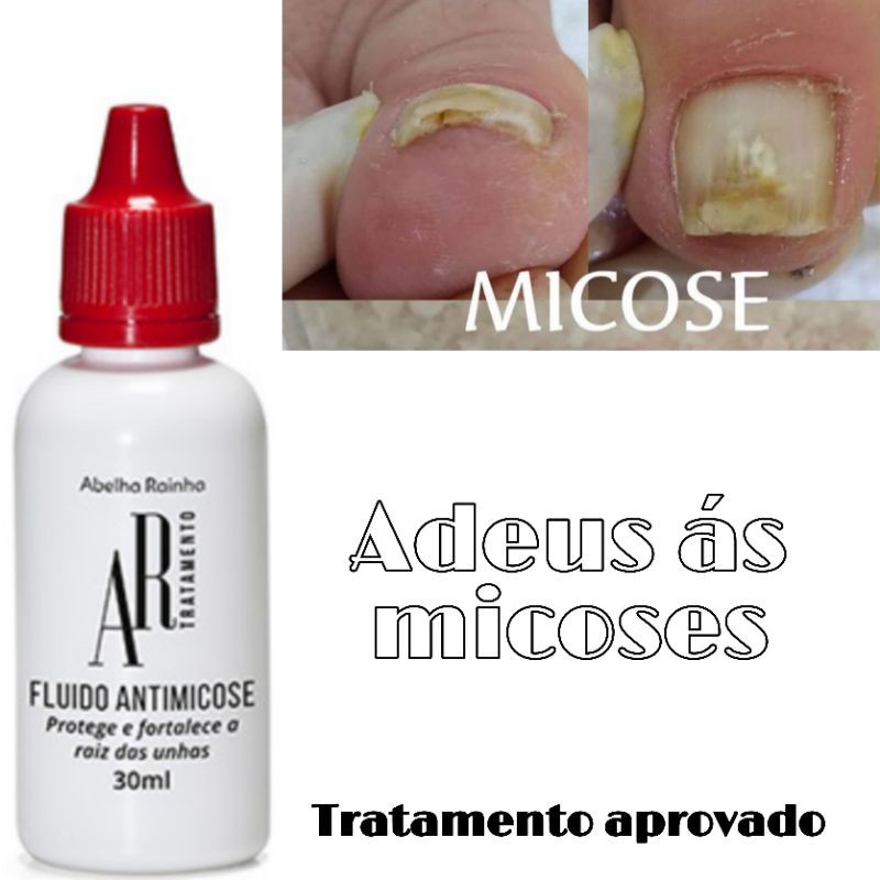 Fluido Anti Micose Ar Tratamento Abelha Rainha 30ml | Shopee Brasil