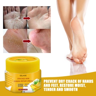 20g Cremes Para Os Pés Óleo Anti-Secagem Creme Rachaduras Remoção De Pele Morta Cuidados Com A Família