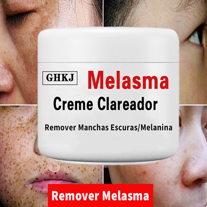 Kit Retinol Creme Facial clarear Tira Melasma Grave Rugas - Max