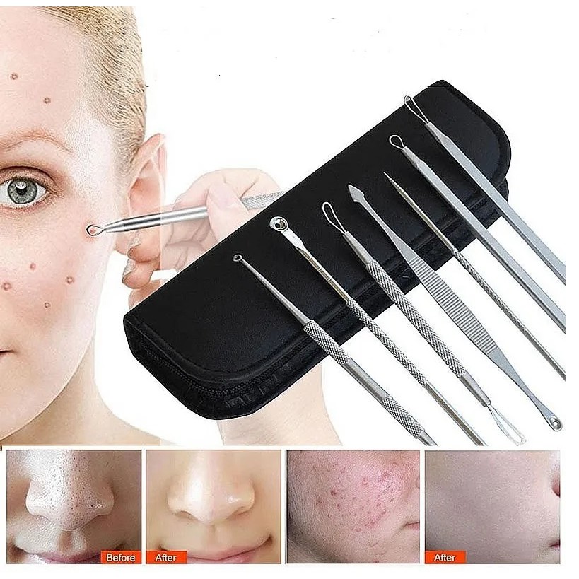Kit 7 Curetas Removedor de Cravos e Espinhas Aço Inoxidável Com Estojo