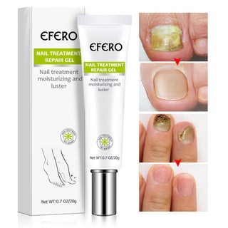 Adicionar Ao Desejo Lista Effero Creme De Tratamento De Unhas Anti-Rescaslar/Cuidados Com As 20g
