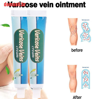 consolidarea venelor varicoz cel mai bun gel de picior varicoza