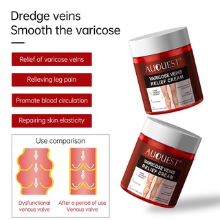 AUQUEST Varizes Creme De Alívio De Véias Vasculite Phlebitis Pomada Da Dor Aranha Médica De Gesso 50g