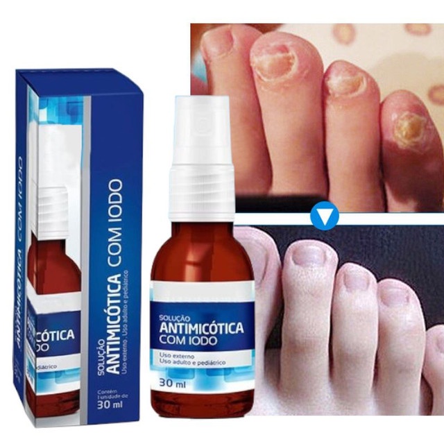 Solução Frieira No Pé Da Mão | Shopee Brasil