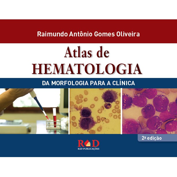 Atlas Hematologia: Onde Comprar | BuscaProdutos