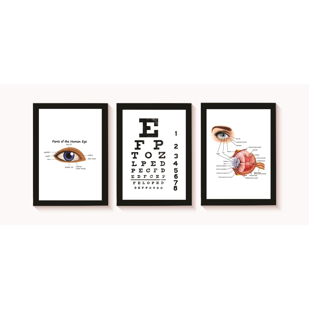 Kit 3 Quadros Decorativos Olhos Exame de Vista Consultório Médico Oftalmologia Molduras 20x30cm Madeira