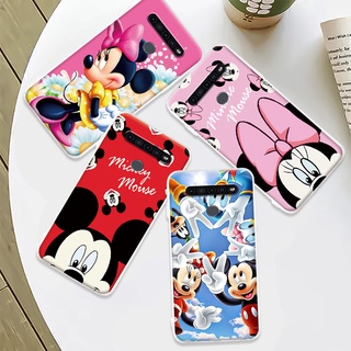Capa De Celular Flexível Tpu Mickey e Minnie Para LG K41S K51S