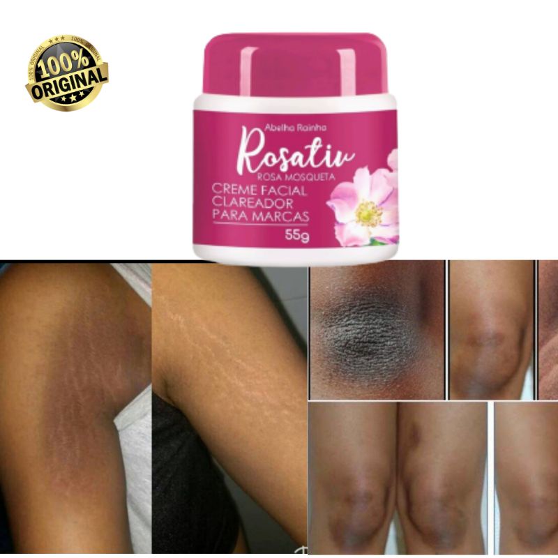 Creme clareador com rosa mosqueta clareamento gradual de manchas na virilha pescoço coxas