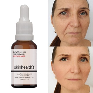 Sérum Nano Retinol 3,5% + Ácido Hialurônico 5% Skinhealth em Oferta na Shopee