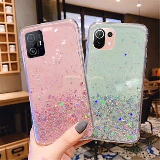 Capa Glitter Para Xiaomi Mi 13T 12T 11 Lite 5G NE 11T Pro Redmi 13C 12C 12C Brilhante À Prova De Choque