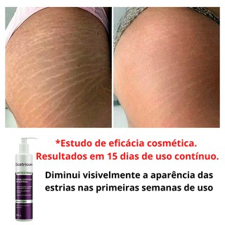 Cicatricure Creme Corporal Antiestrias 250g c/ Rosa Mosqueta