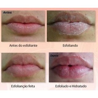 01 Esfoliante Labial P/ Lábios Ressecados original