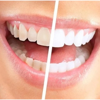 Whitemax 100% Natural Super Promoção