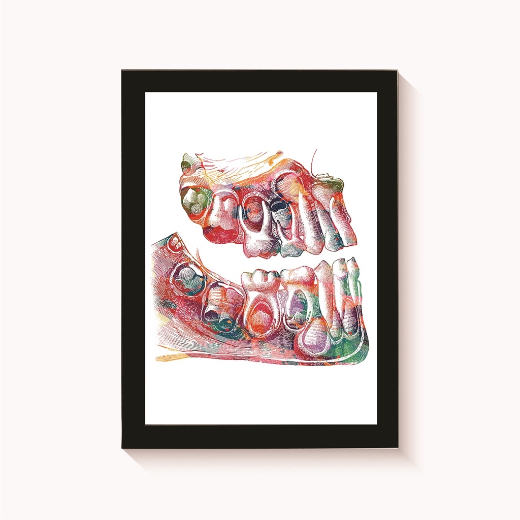 Quadro Decorativo Arcada Dentária Infantil Aquarela Odontologia Moldura 20x30cm Madeira Vidro Cor Preta