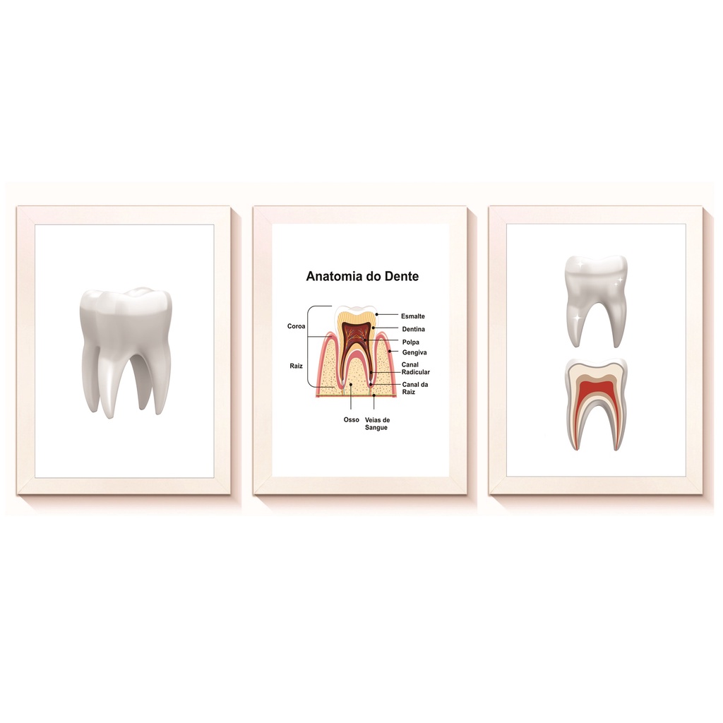 Kit 3 Quadros Decorativos Dentes Decoração Consultório Odontologico Molduras 20x30cm Madeira