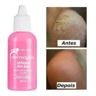 Milagre Dos Pés Dermopés Loção Para Afinar Os Pés Trata e Afina Abelha Rainha 30ml