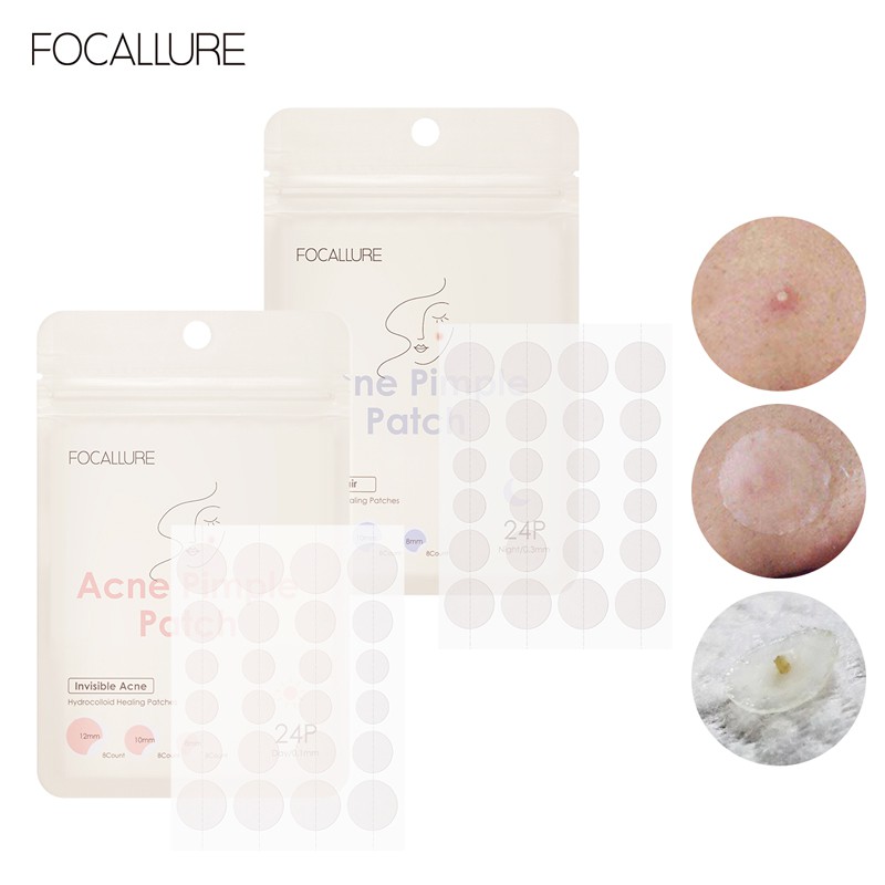 Conjunto Focallure Patch Acne Tratamenta De Manchas Cuirados Com Uma Pele Reparo De Acne Prova D 'Gua 24p