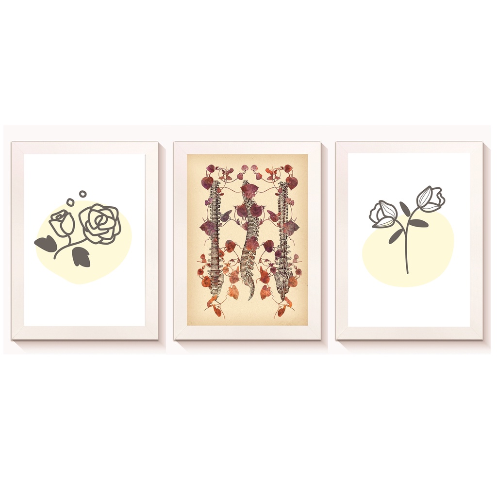 kit 3 Quadros Decorativos Coluna Vertebral Consultório Clínica Ortopedia Fisioterapia Moldura 20x30cm Madeira Branca