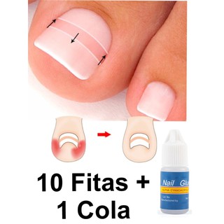 Fita Órtese Corretora Para Unha Encravada Desencravador 10 Pçs Cola