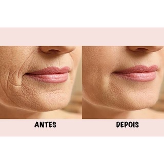clareador facial manchas acne melasma cicatriz rugas enviamos de imediato