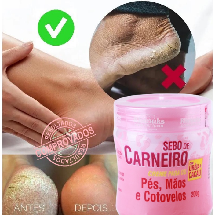 Creme de reparo calcanhar rachado anti-ressecamento hidratante tratamento de rachaduras para os pés e cuidados das mãos O Melhor do Brasil