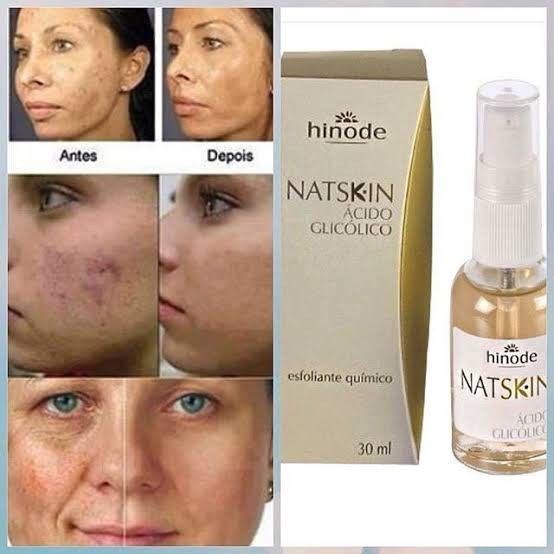 Ácido glicólico hinode routine serum elimina sardas acne, mançhas e linha de expressão Solução Facial Ácido Glicólico Routine Dermo