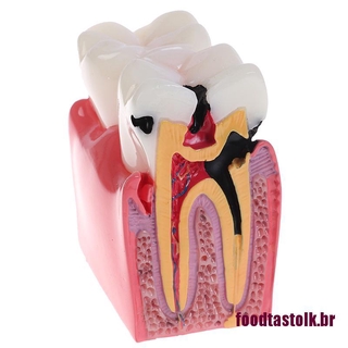 < efgrgh > Dental Dentes Modelo 6 Vezes Estudo De Comparação De Carros De Dentadura