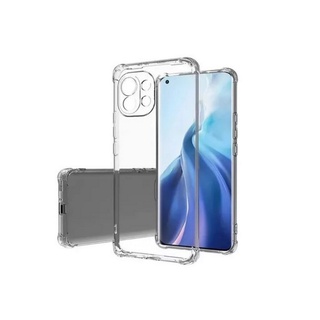 Capa Transparente Anti Xiaomi Mi 11 Lite