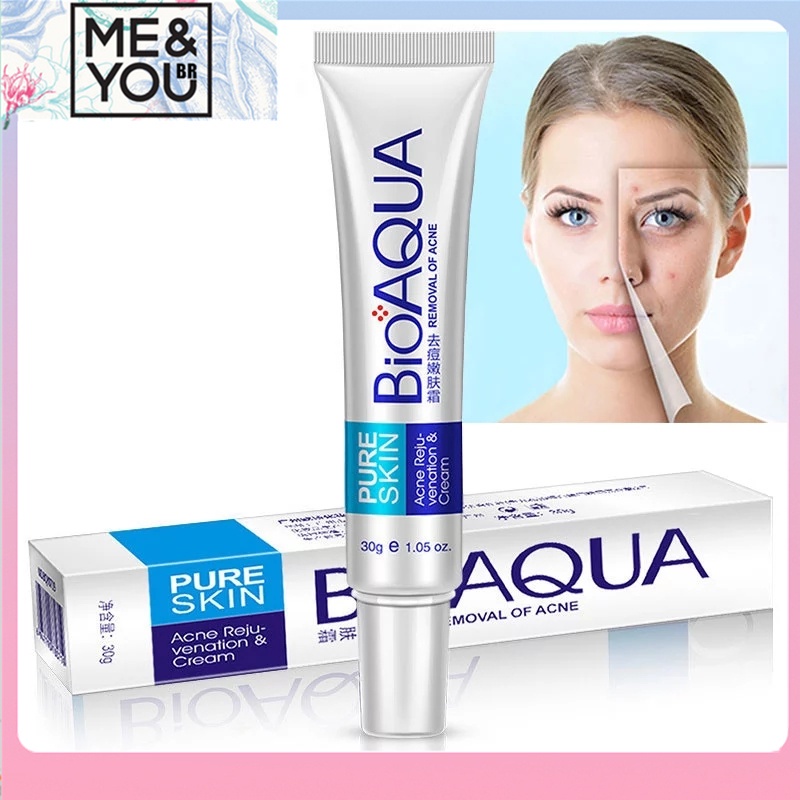 Bioaqua Creme De Tratamento Para Remover Cravos / Cicatrizes / Remover As Poros / Acne / Tratamento De Tratamento Facial