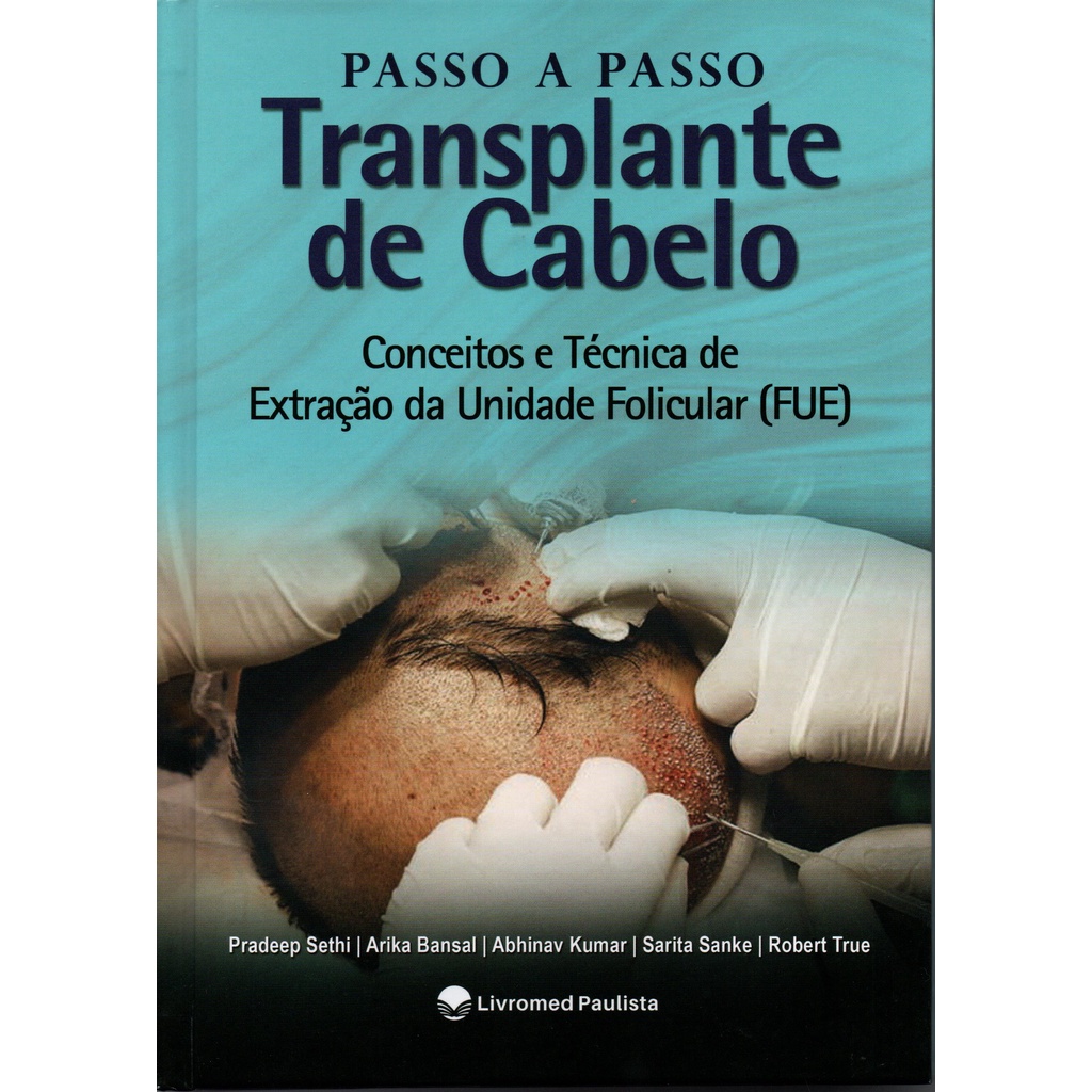 PASSO A PASSO TRANSPLANTE CAPILAR CONCEITOS E TÉCNICA DE EXTRAÇÃO DA UNIDADE FOLICULAR (FUE)