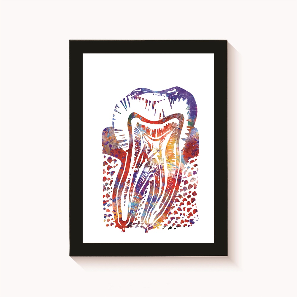 Quadro Decorativo Dente Aquarela Colorida Decoração Consultório de Odontologia Moldura 20x30cm Madeira