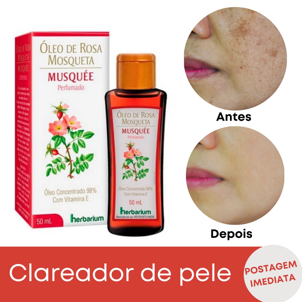 Óleo De Rosa Mosqueta Facial Com Vitamina E Clareador De Pele 50ml ...