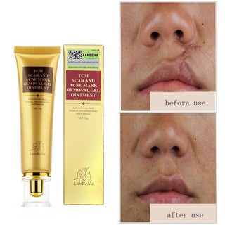 Creme De Remoção De Cicatrizes / Acne Lanbena Para Reparo Da Pele 30ml Profissão