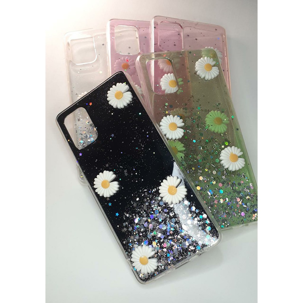Capa Capinha p/ Samsung Galaxy A71 Personalizada Capa p/ A71 Com Gliter Capa p/ A71 Feminina detalhes 3D