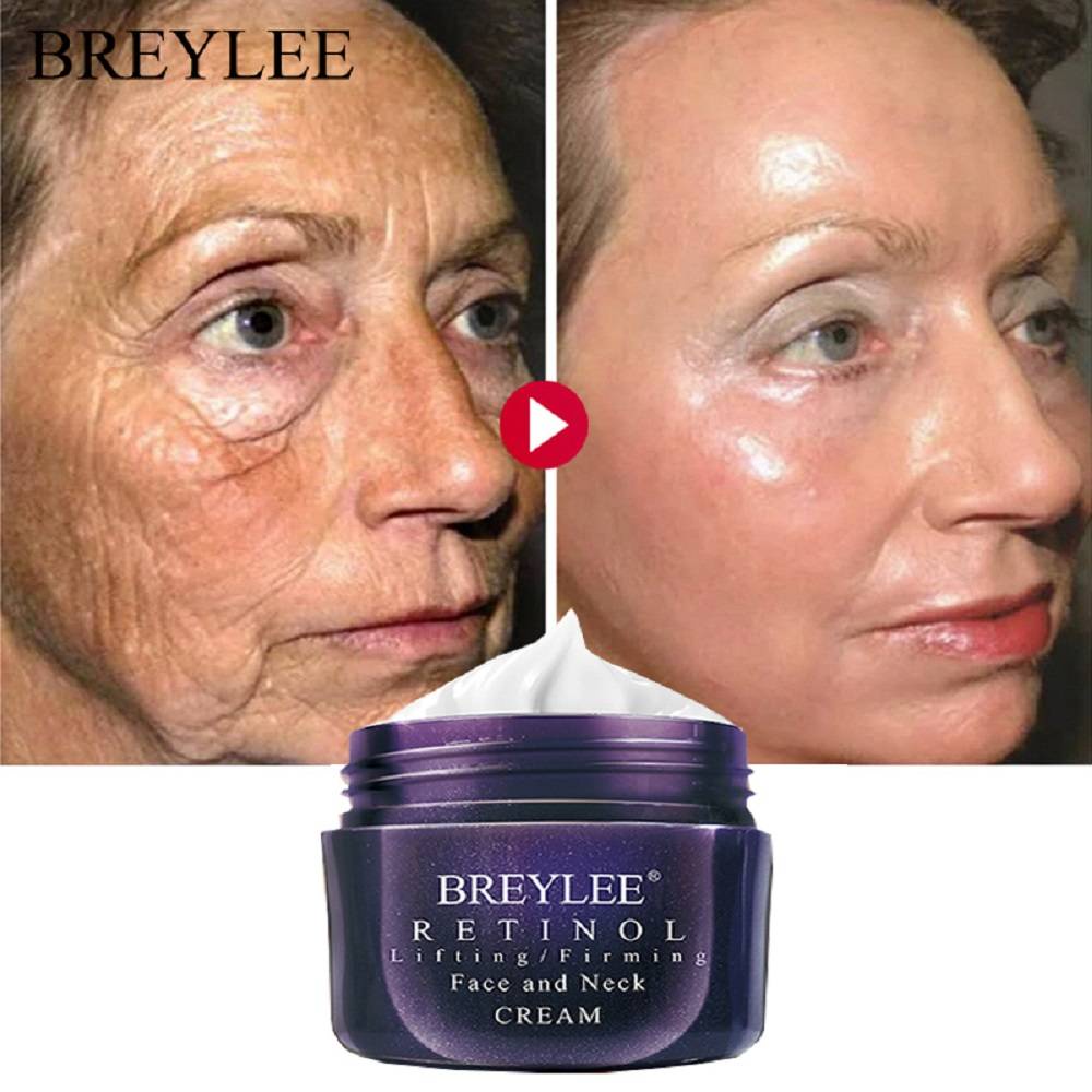 Qual é o melhor creme para rugas?