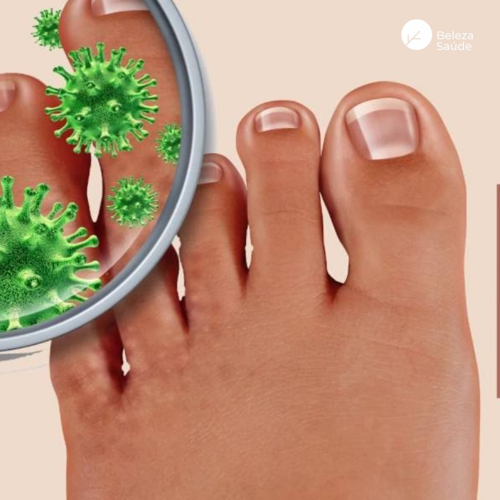 Ciclopirox Olamina para Unhas 10ml: Onde Comprar | BuscaProdutos