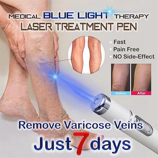 Caneta Terapêutica De Claro Azul Para Varizes / Terapia Laser Rugas / Acne