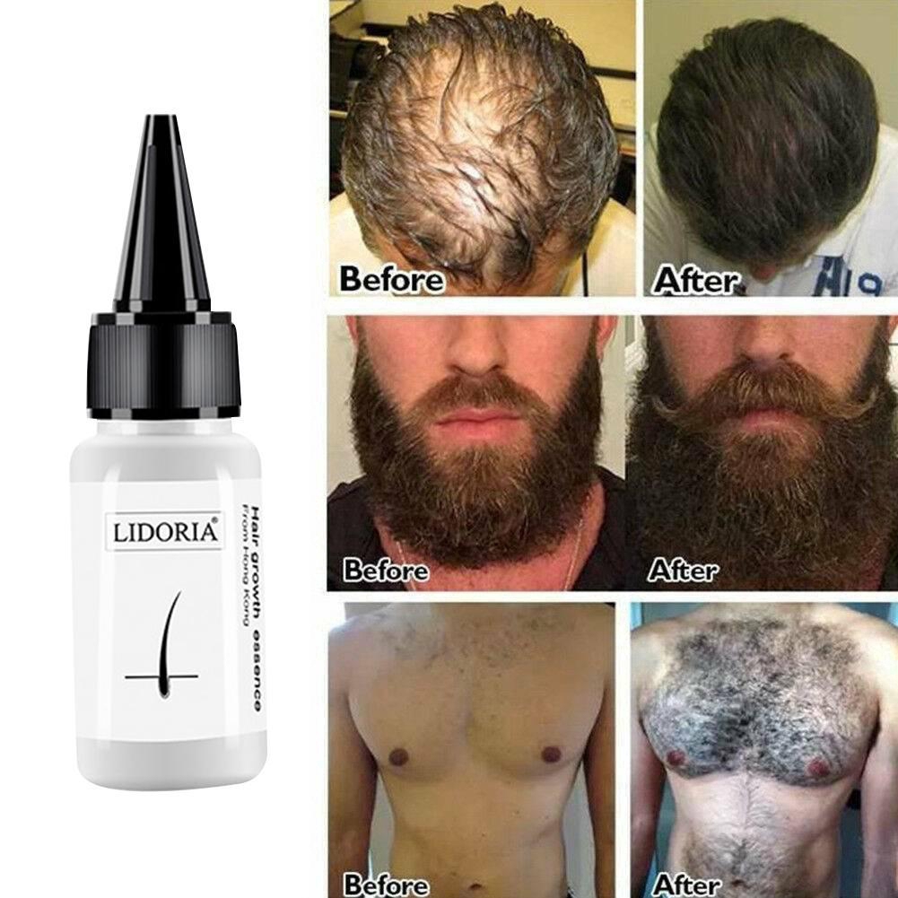 Lidoria 20ML Crescimento De Cabelo Essência Óleo De Barba Soro Produtos Antiqueda