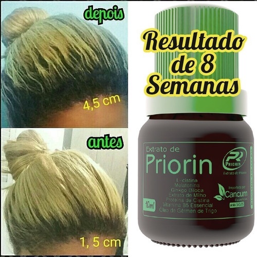 Cresce Cabelo  - Tônico Cresce Pelo - Extrato de Priorin