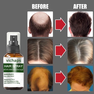Spray De Crescimento De Cabelo , Queda Tratamento De Careca De Linha Do E Padrão Para Homens Mulheres Com Cabelos Desbaste