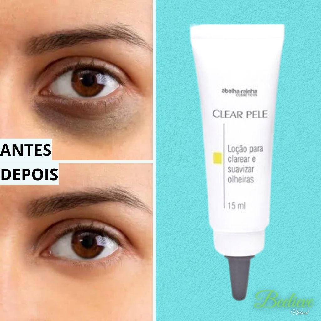 Loção Para Clarear E Suavizar Olheiras Clear Pele 15ml Abelha Rainha