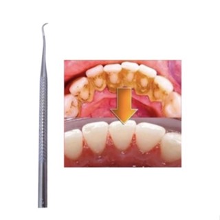 Extrator de Tártaro N° 3 - Limpeza Dental Raspagem - WL