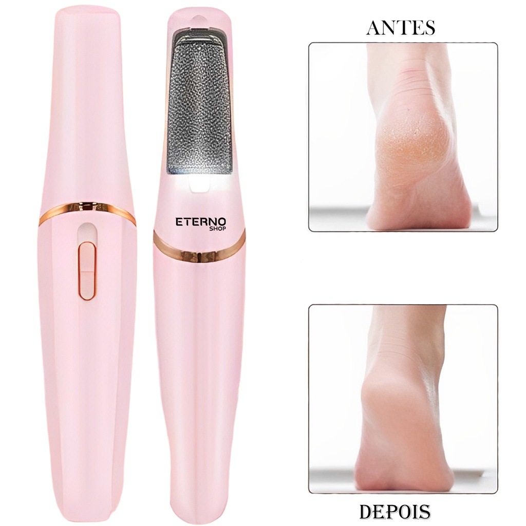 Lixador De Pé Elétrico Esfoliador Tira Calos Pedicure Portátil Marisa Lixa Elimina Calo Portátil Usb